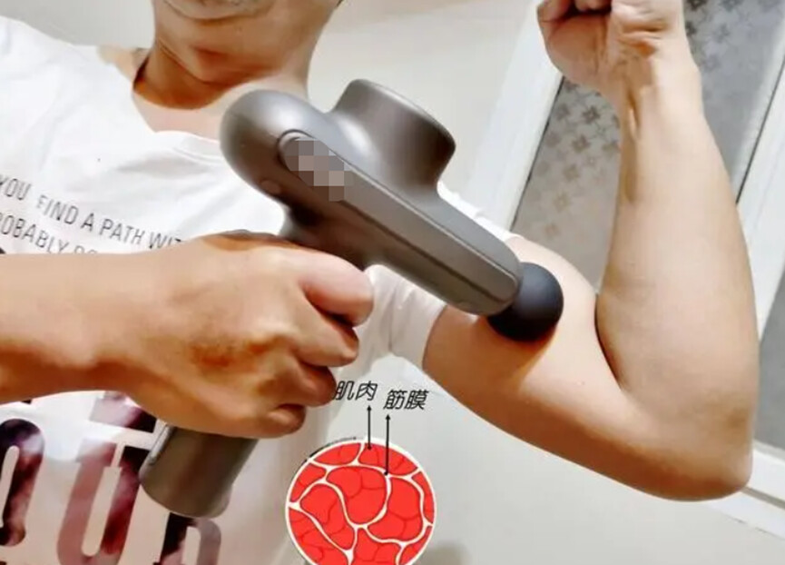 筋膜槍正確使用指南 切莫忽視這三大潛在風(fēng)險(xiǎn)