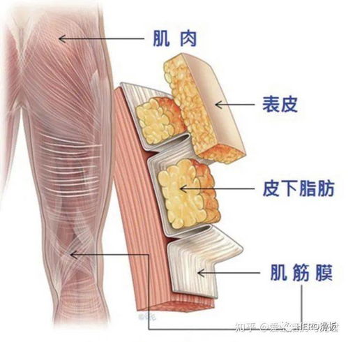 筋膜槍的工作原理及注意事項(xiàng) 正確使用避免損傷